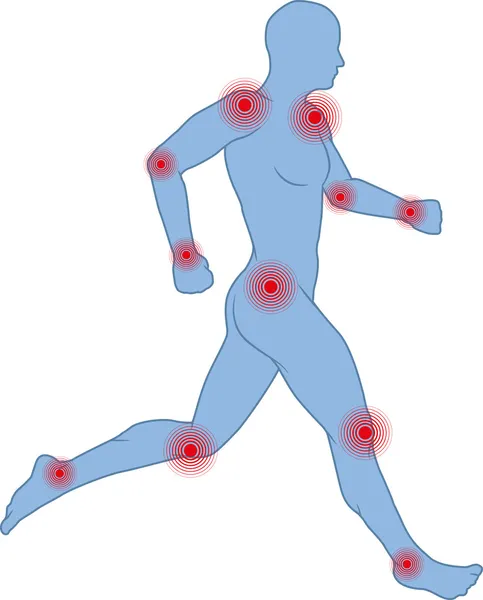 ízületi fájdalom clipart