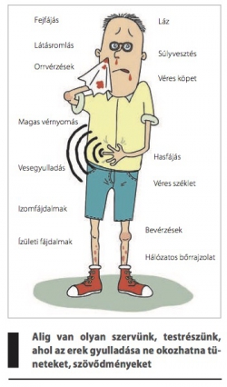 hogyan lehet kezelni az erek artritiszét
