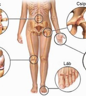 ízületi fájdalom és remegés szemfájdalom és ízületi fájdalom