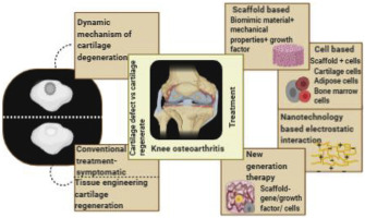 Undenatured type II collagen in the treatment of osteoarthritis