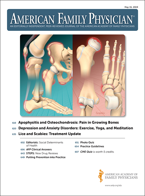 térd osteochondrosis vélemények)