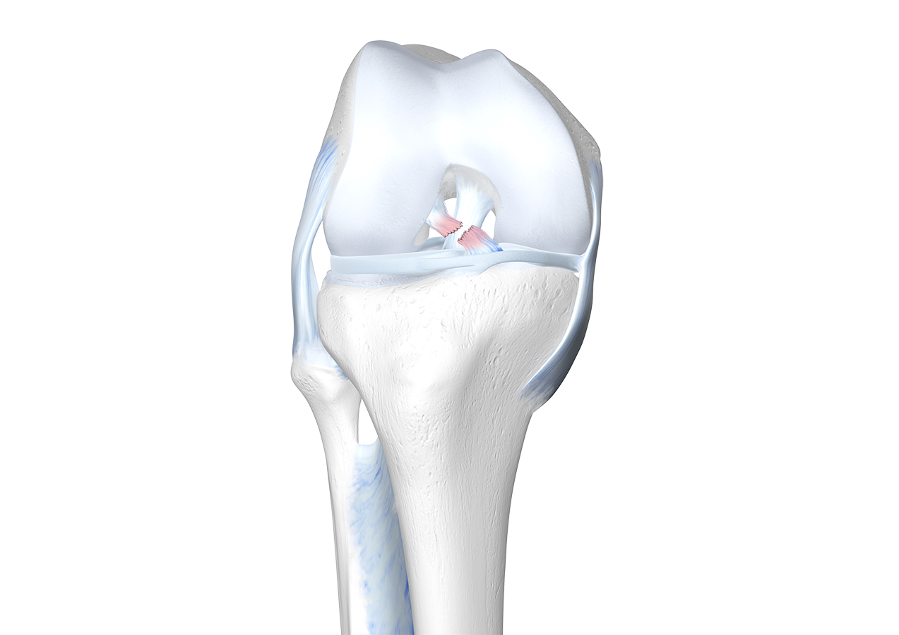 cruciate ligament ligament térdkezelés