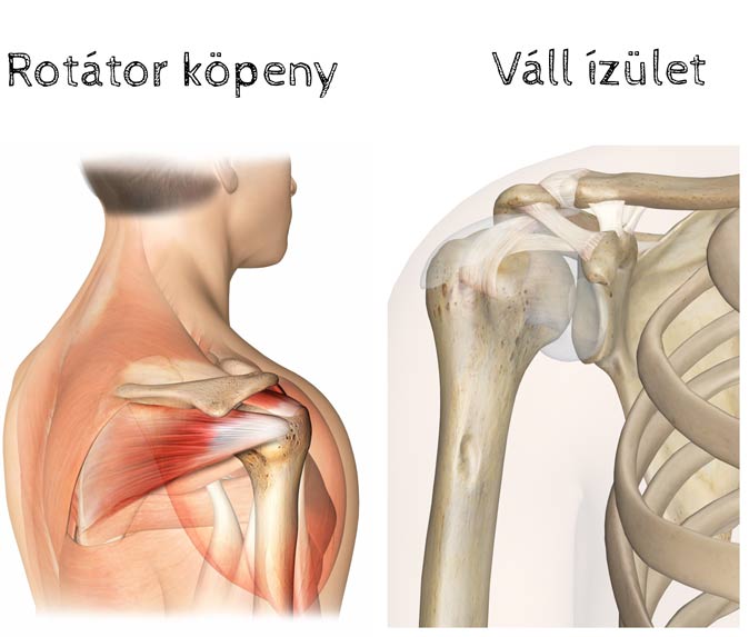 Az egyik vállra esés ízületet fáj