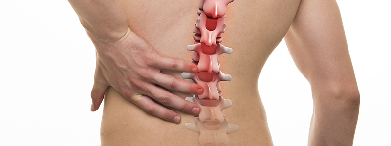 a halom osteoarthritisének kezelése