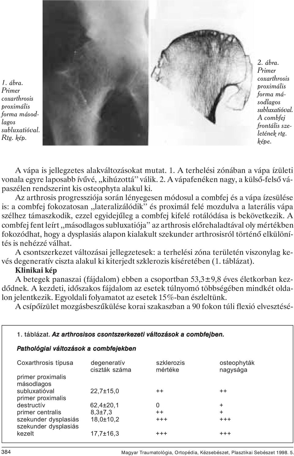 artrózis a csípőízület 2 3 fokú kezelése)