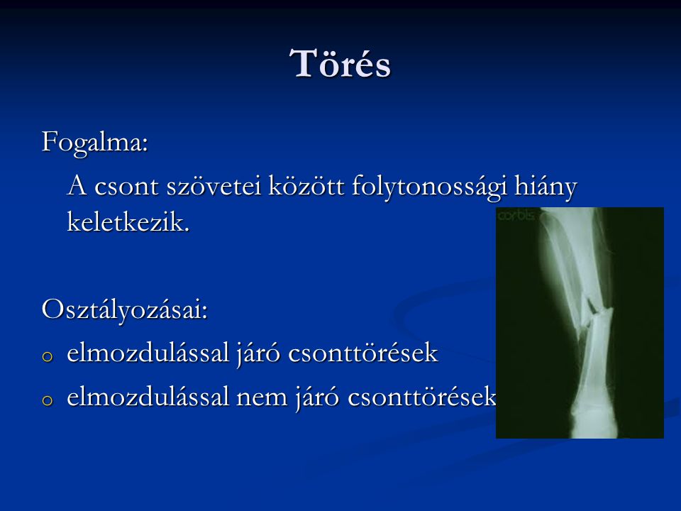 izületi sérülések fajtái)