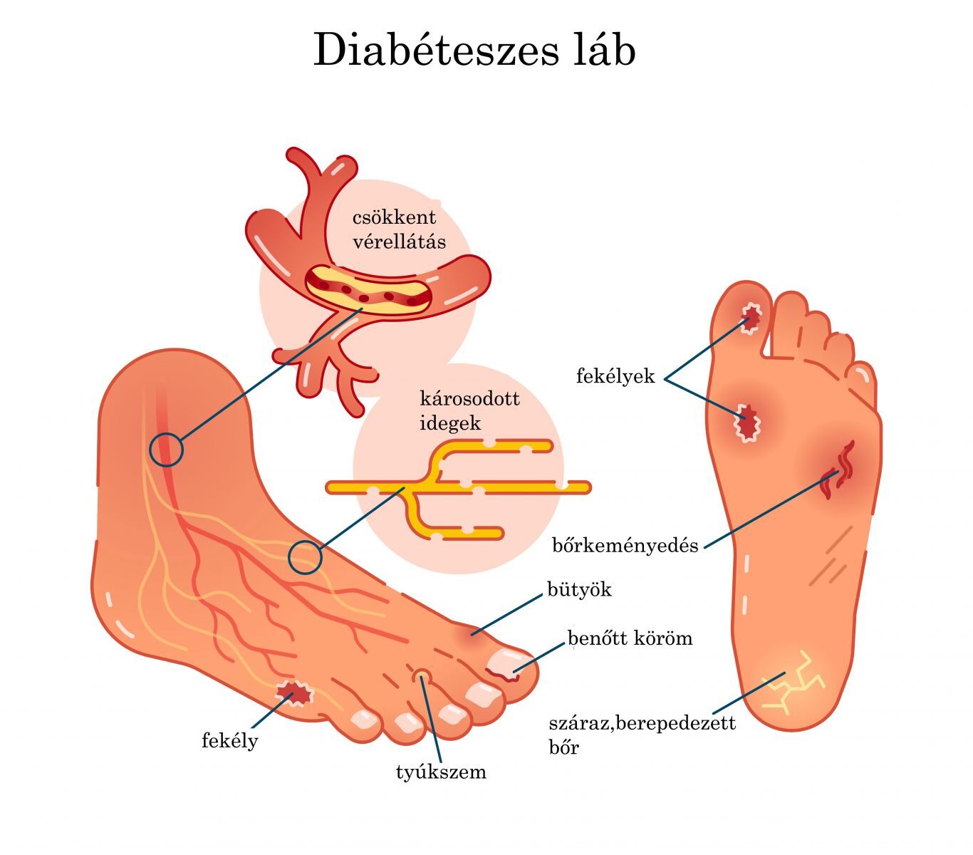a láb diszlokációjának kezelése