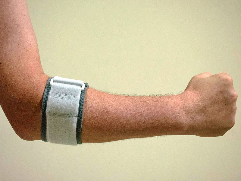 A könyökízület bursa-gyulladása, Kiváltó okok: nyomás, sérülés vagy anyagcserezavar