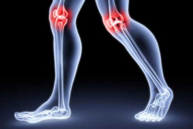 hogyan lehet kezelni a térd osteoarthritist ozokerittel)