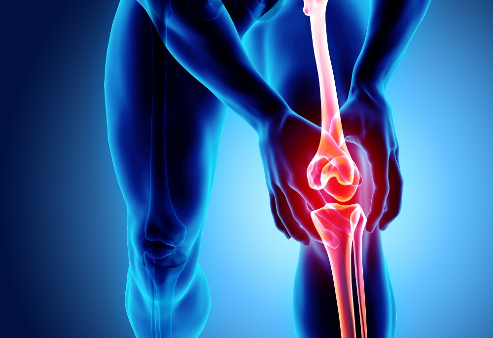 a térd mediális mellékmegkötésének károsodásának kezelése)