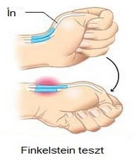 hüvelykujj fájdalma csukló)