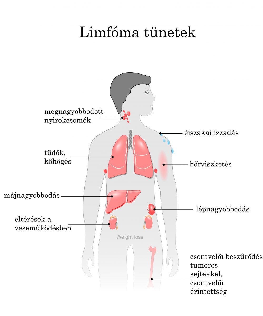 az ízületek limfómában szenvednek)