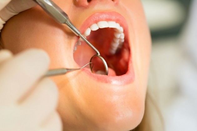 ALVEOLITIS ( FOGMEDERCSONT GYULLADÁS) - Tóváros Laser Dental