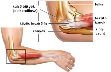 szárnyaló lábak ízületi fájdalommal