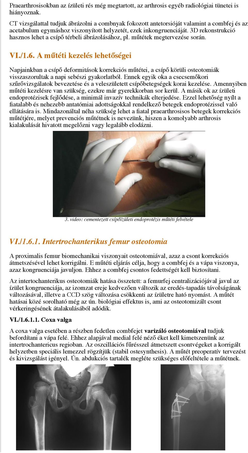 hogyan lehet gyógyítani a térdízület osteochondrozist