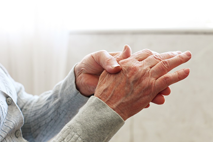 meleg ízületek rheumatoid arthritisben