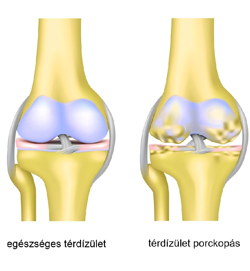 a csípőízület belső forgása