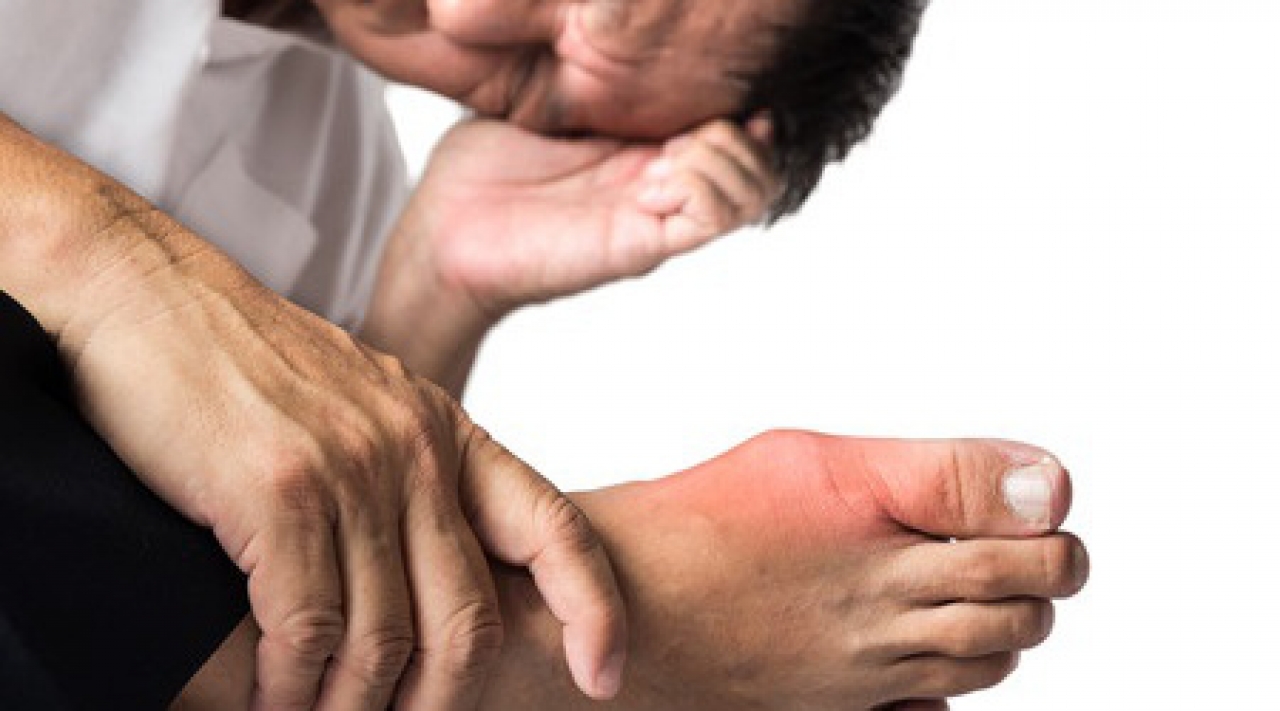orosz tudósok felfedezése az artrózis kezeléséről a heparin kenőcs segít az osteochondrosisban