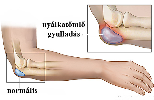 nyelvrák lelki okai