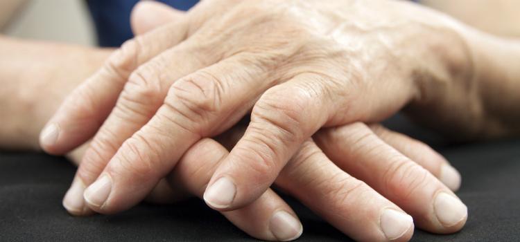 a lábak ízületeinek polyarthritis kezelése gyógyszerek