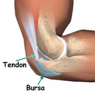 térdízületi betegség és a bursitis kezelése)