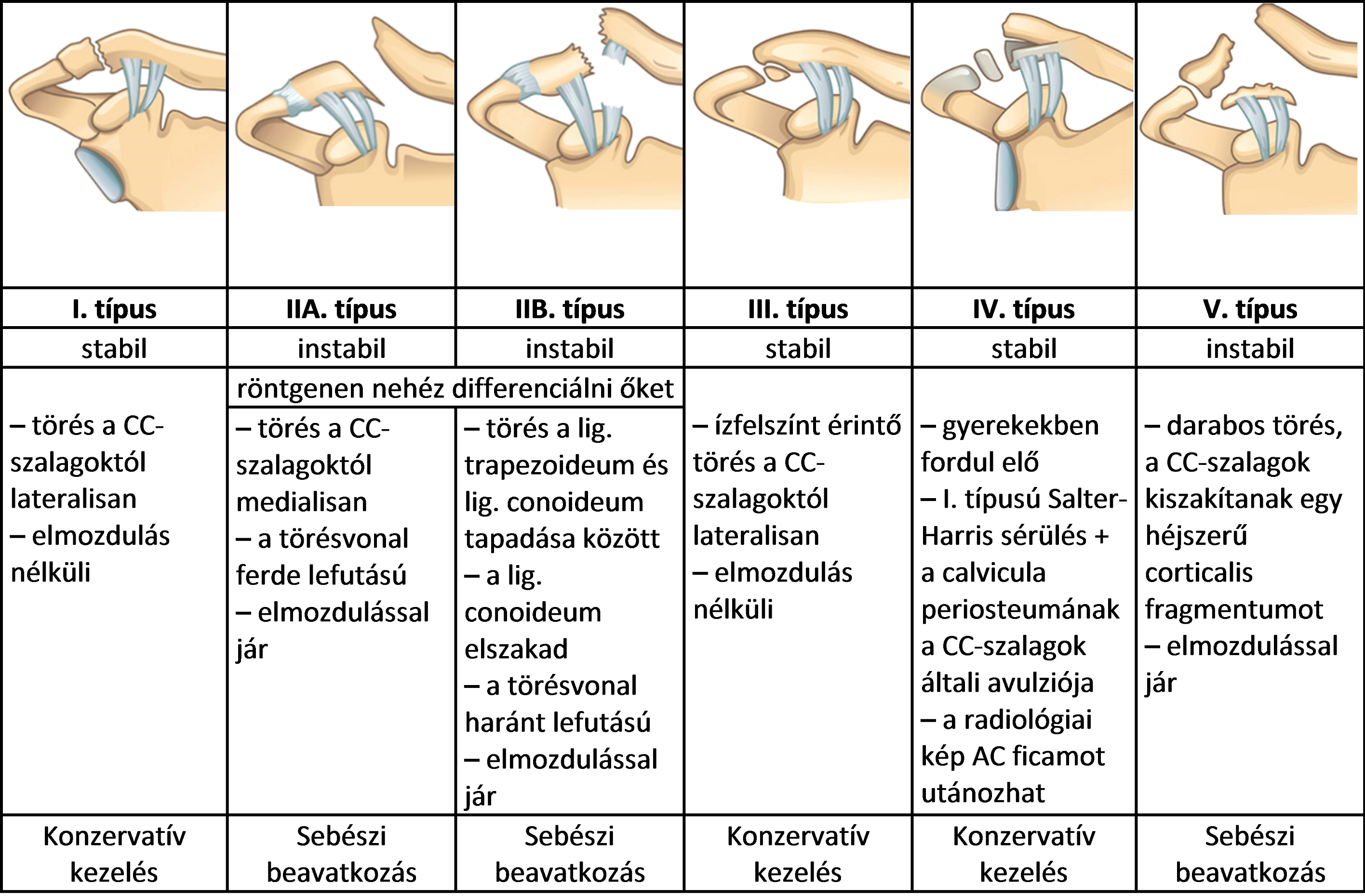 ízületi sérülések osztályozása)