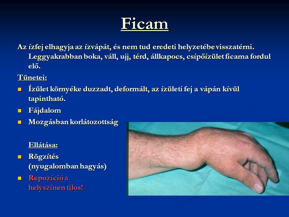 ízületi sérülések)