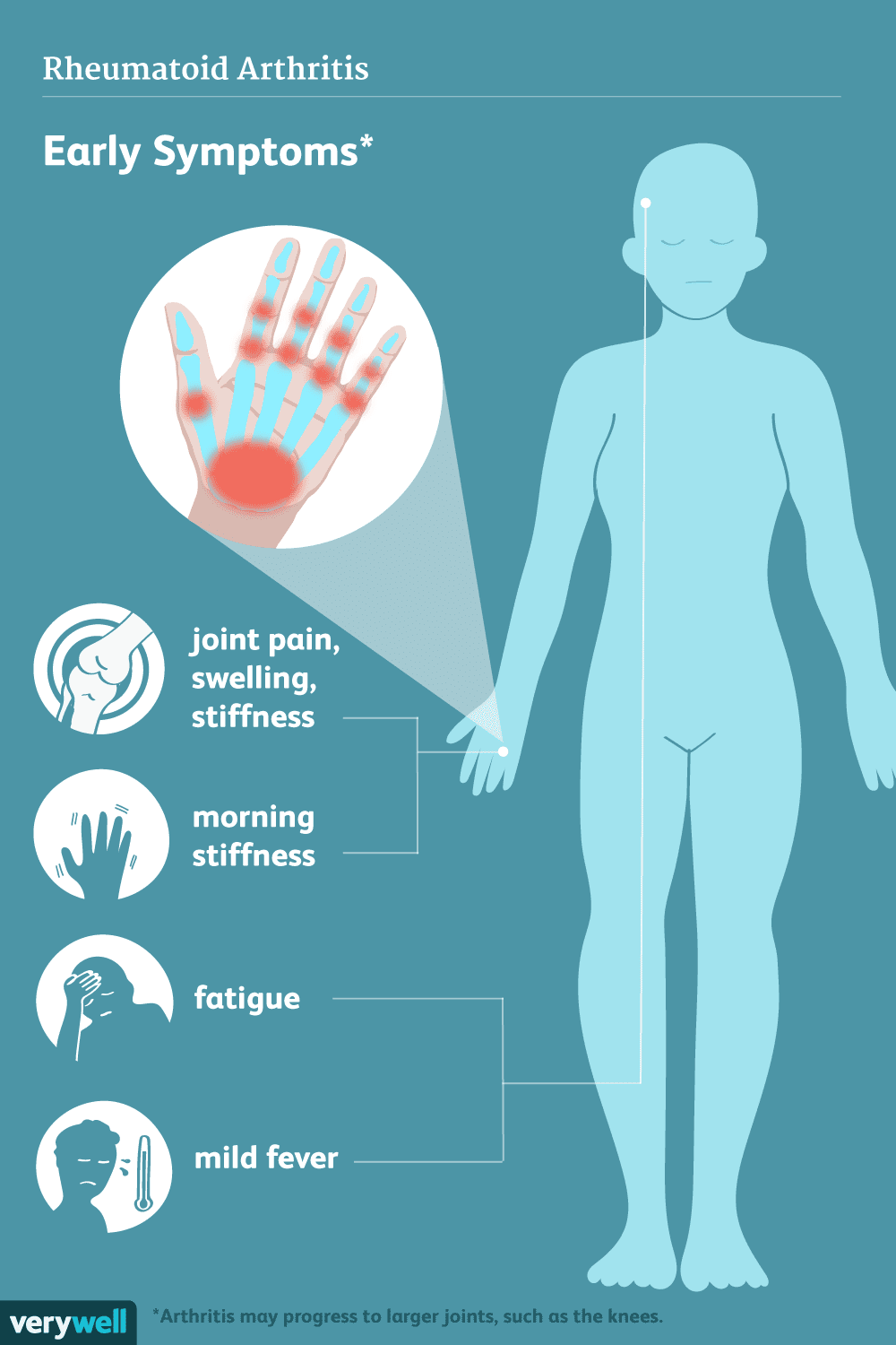 osteoarthritis symptoms fatigue