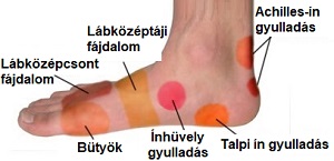 ízületi fájdalom a láb felső részén