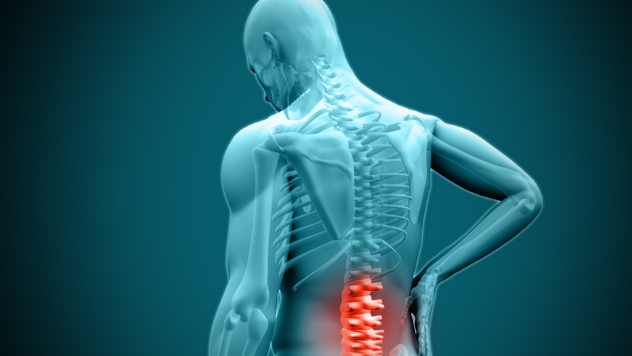 táplálkozás artrózis kezelésére kezdeti osteochondrosis