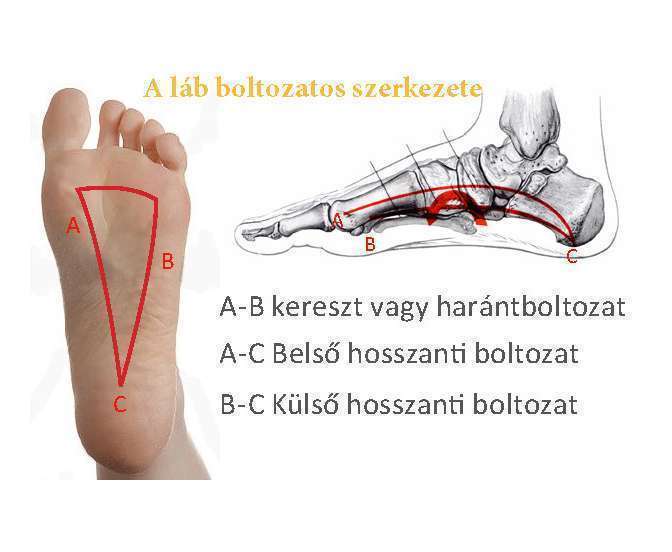 hallux valgus kezelés felnőtteknél