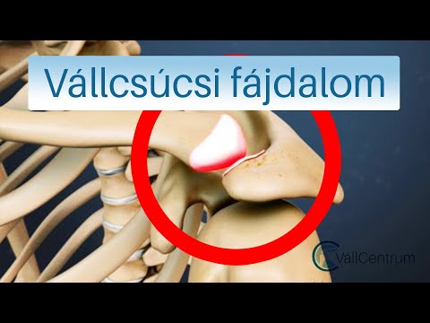 homeopátiás kenőcsök nyaki osteochondrozishoz)