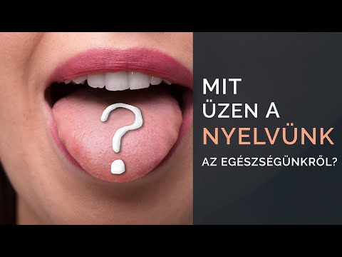 mit átszúrni a lábak ízületeiben fellépő fájdalommal sofia krém ízületi fájdalmak kezelésére