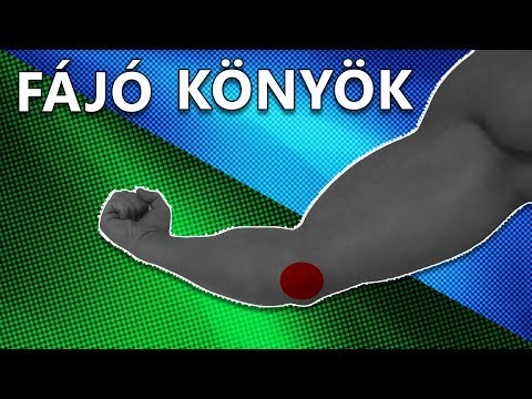 Befagyott váll szindróma – a szűnni nem akaró vállfájdalom oka