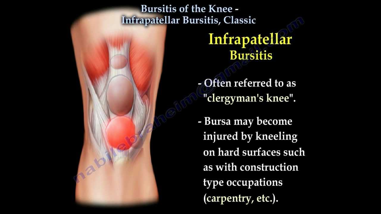 Könyökízület bursitis kezelése. Nyáktömlő-gyulladás / Bursitis - Fájdalomközpont