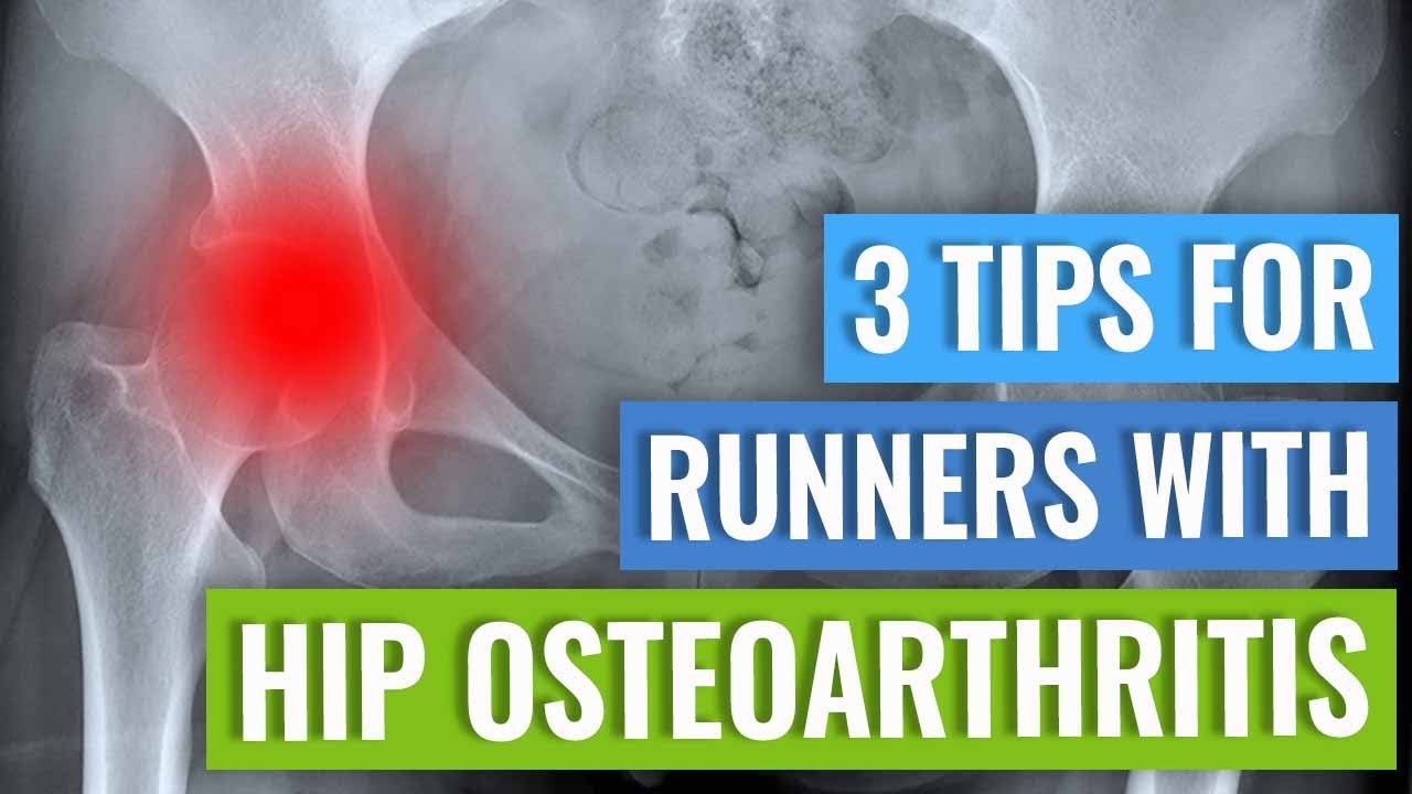 osteoarthritis fiatal korban)