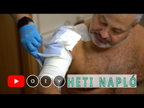 Vállfájdalom kezelése - 10 tippünk is van! | Házipatika
