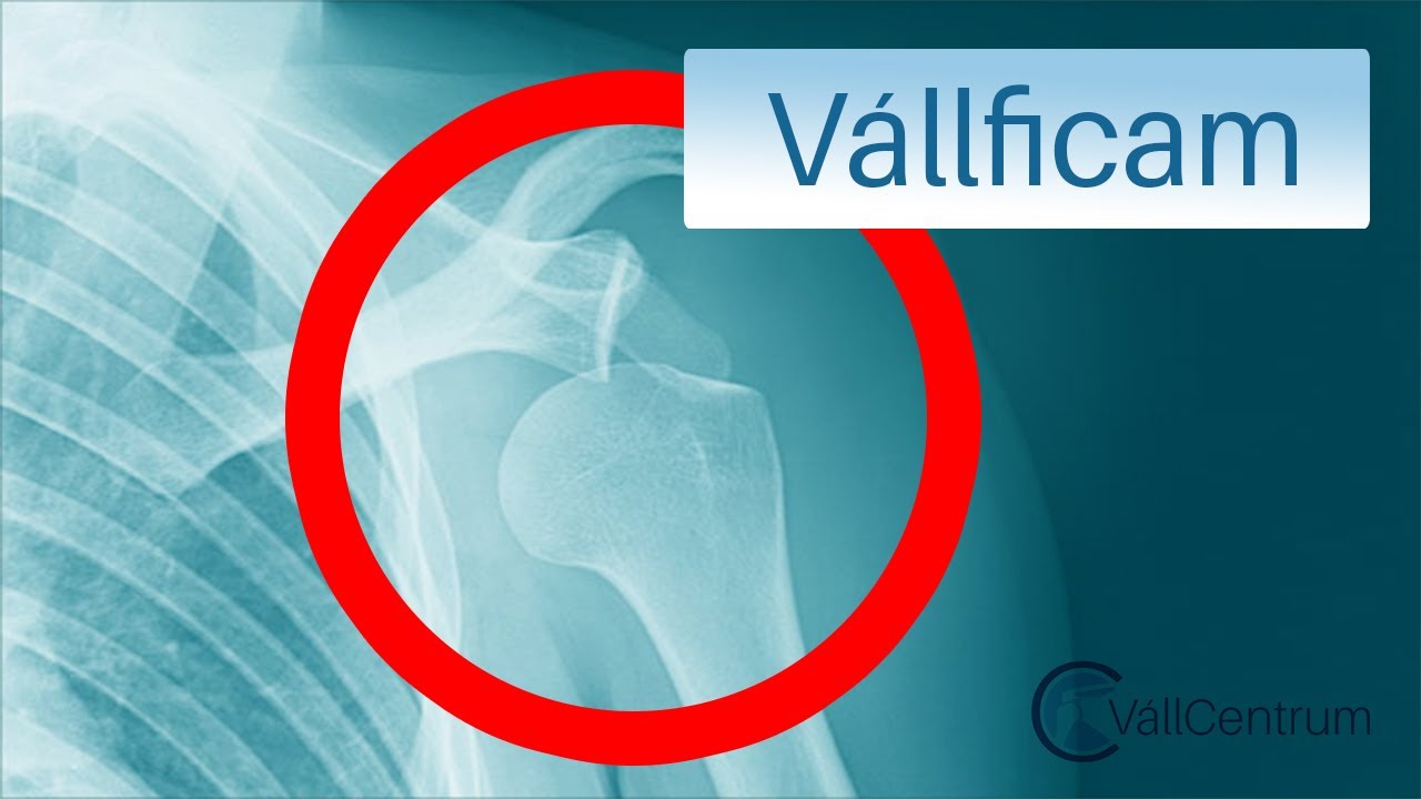 váll fájdalom ütés)