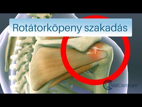 ízületi kezelőfelszerelés