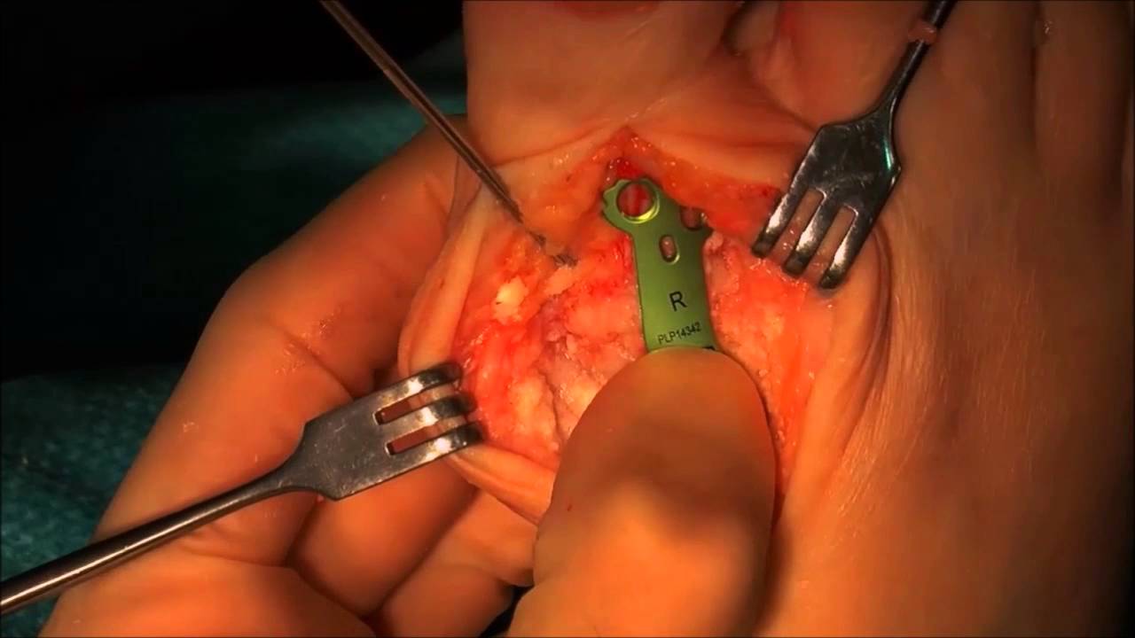 ízületi fájdalom melegen nem szteroid gyógyszerek az osteochondrosis kezelésében