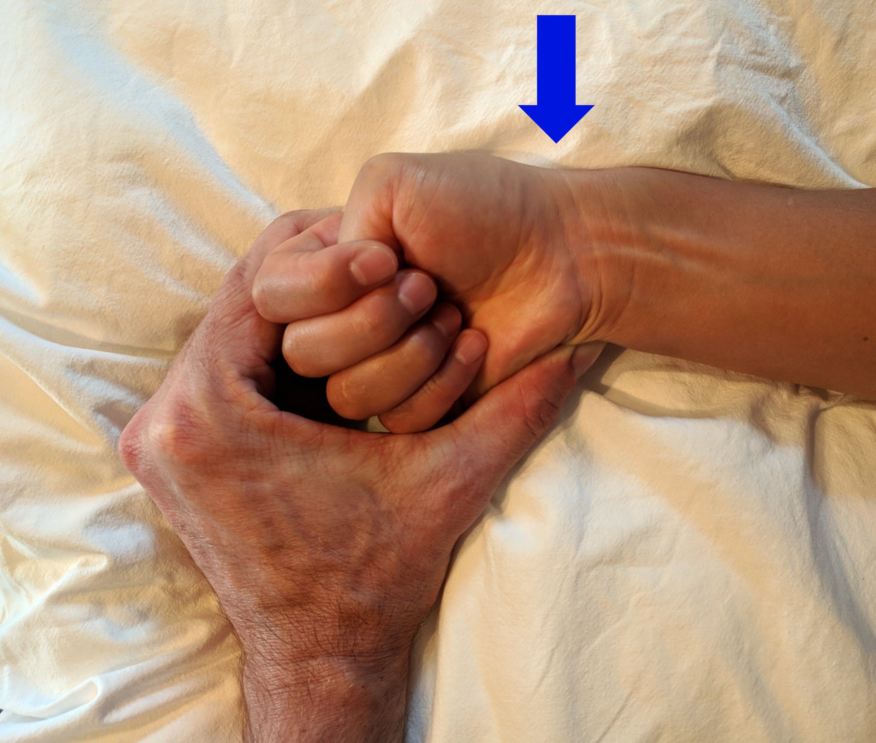 de quervain syndrome test