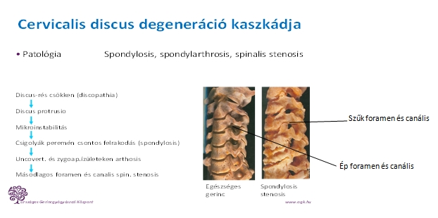 ízületi és gerincbetegségek tünetei