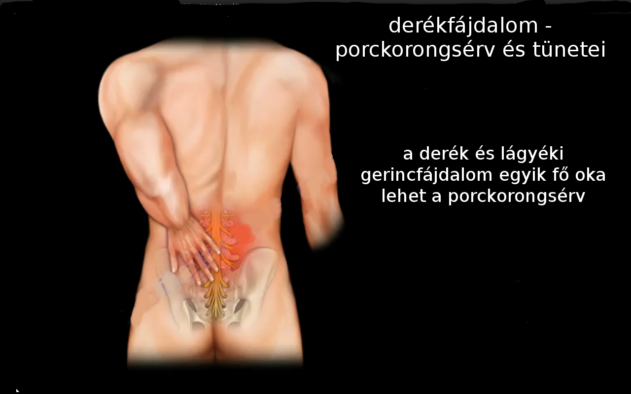 derékfájás kezelése ropogás és ízületi fájdalom mint a kezelés