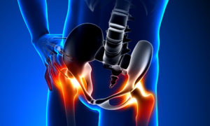 labdarúgás után fáj a csípőízület kortikoszteroid gyógyszerek osteochondrozissal szemben