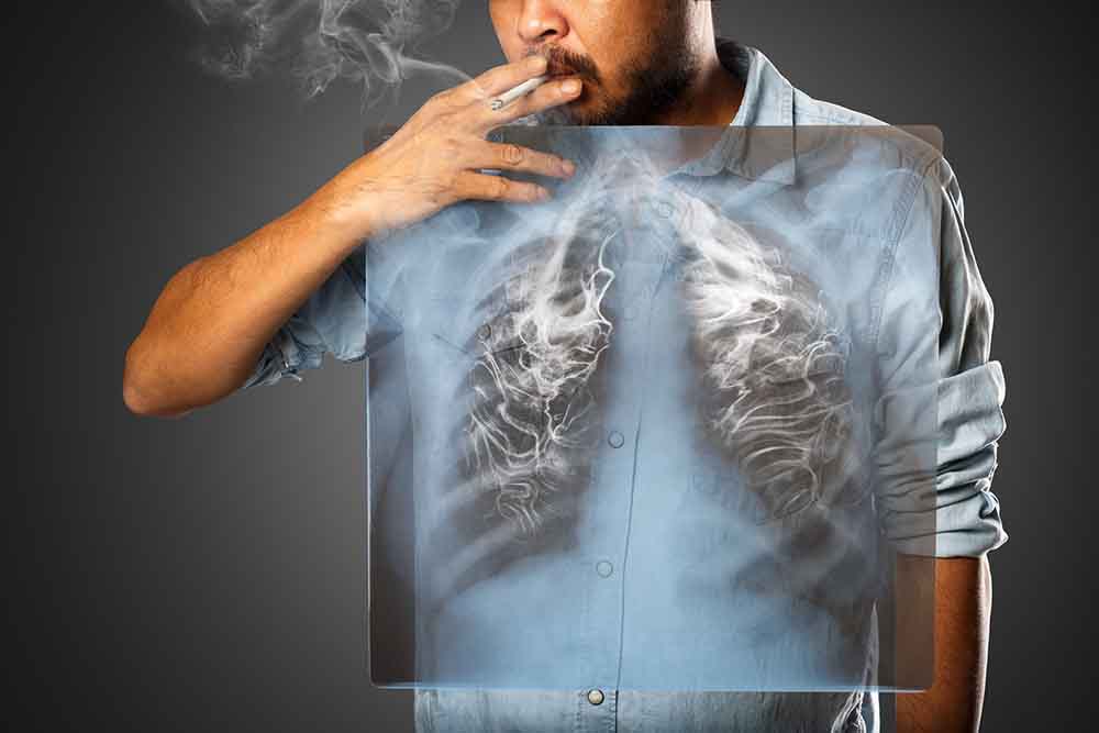 A dohányzás cardiovascularis hatásai