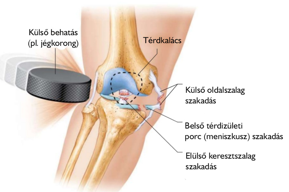 rheumatoid arthritis ízületi gyulladása ártalmas termékek ízületi fájdalmakhoz