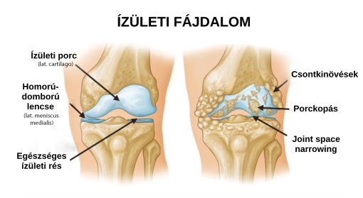 sárga krém az ízületi fájdalomtól tart)