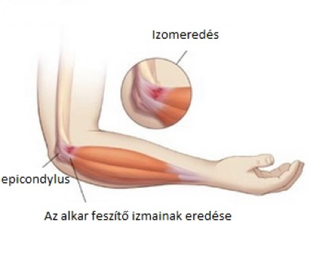 Betegségekről