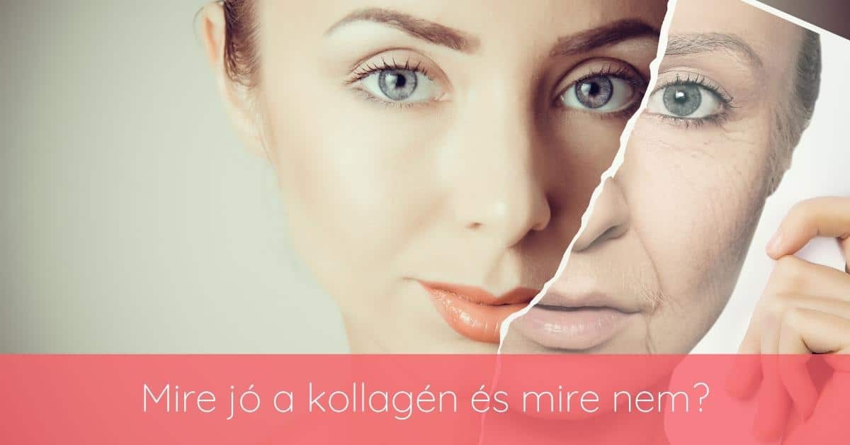 A kollagén típusai - I., II. és III. típusú kollagén